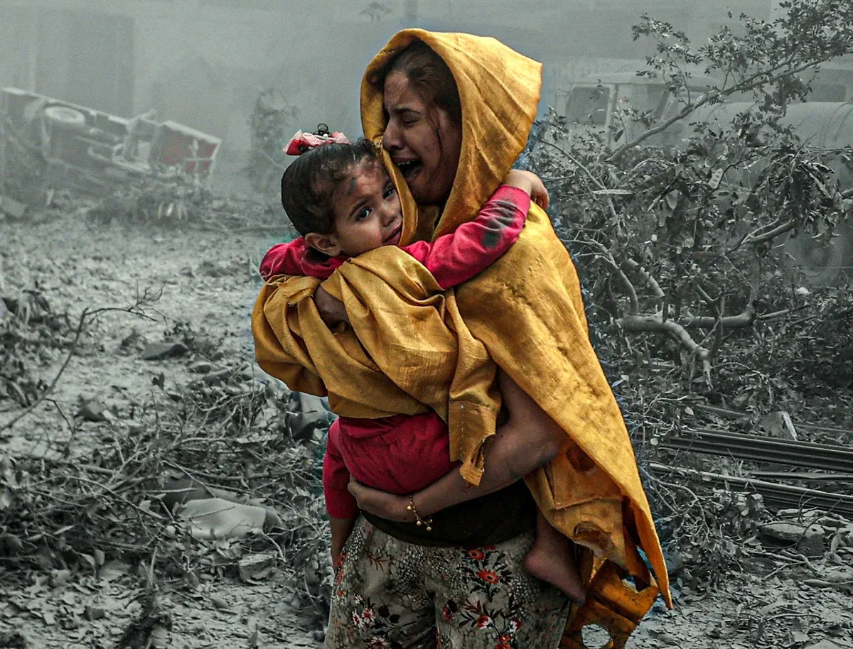 Gaza has the highest number of child amputees in modern history